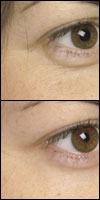 aging cream | anti aging cream | best wrinkle | aging creams | wrinkle cream :  wrinkle creamwrinkles creamwrinkle aging